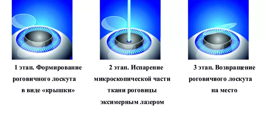 Akių Lazerinės Chirurgijos Centras Онлайн консультация офтальмолога